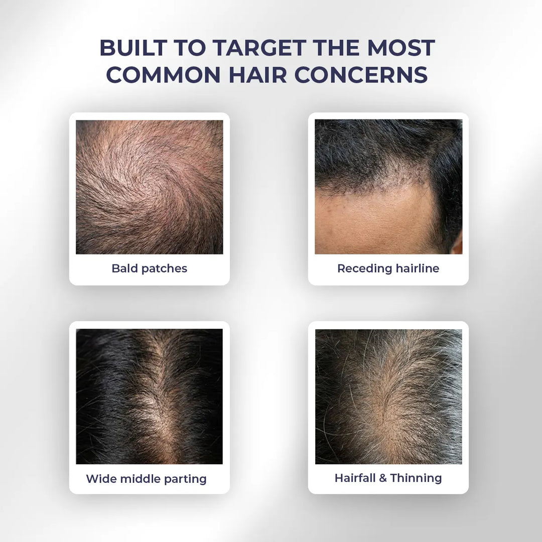 Anti-Hairfall Strength Duo | Shampoo & Conditioner | Reduces Hairfall & Frizz | Combo