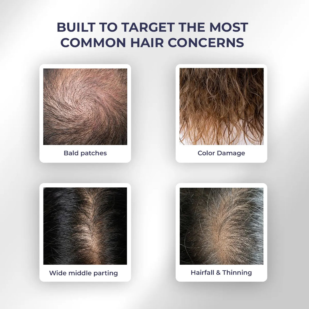 Essential Anti Hair Fall Kit | Reduce Breakage & Improve Strength