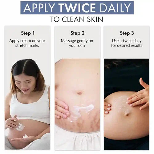 ThriveCo Stretch Mark Expert Serum Cream - 30 ml