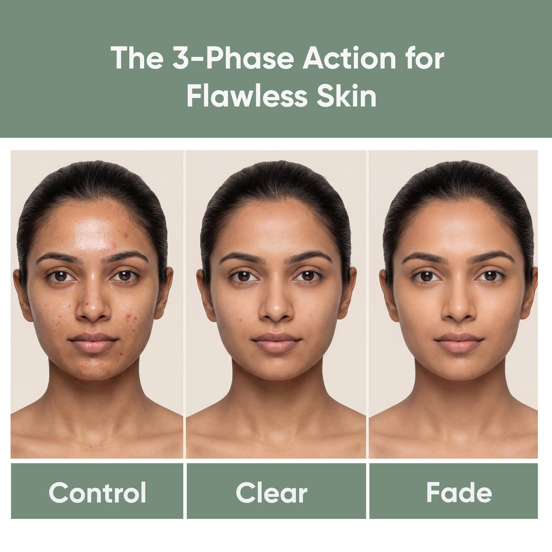The D Wave Sebi-Clean Gel Crème - 30 ML | Reduce Acne, Fade Dark Spots, Brighten Skin | Powerful Acne Treatment, Skin Illuminator & Brightening