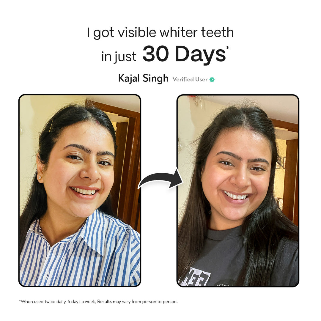 Habbits Whitening Toothpaste (100g) + Teeth Whitening Powder (50g) Combo | 2 Plant-Based Wheat Straw Toothbrush | Long Lasting Freshness | n-HAp & Hyaluronic Acid | Fluoride & Peroxide Free