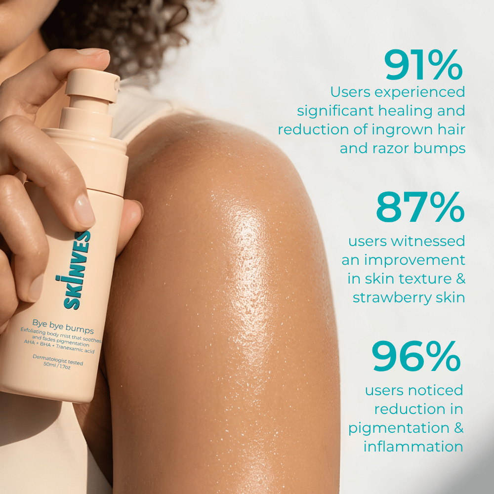 Skinvest Bye Bye Bumps 50ml For Men & Women