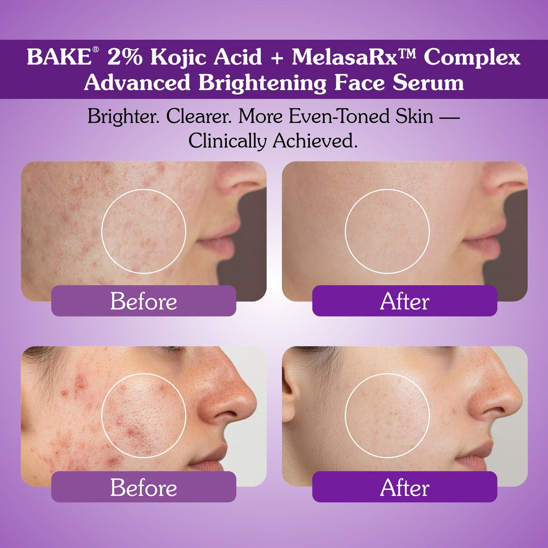 2% Kojic Acid Face Serum