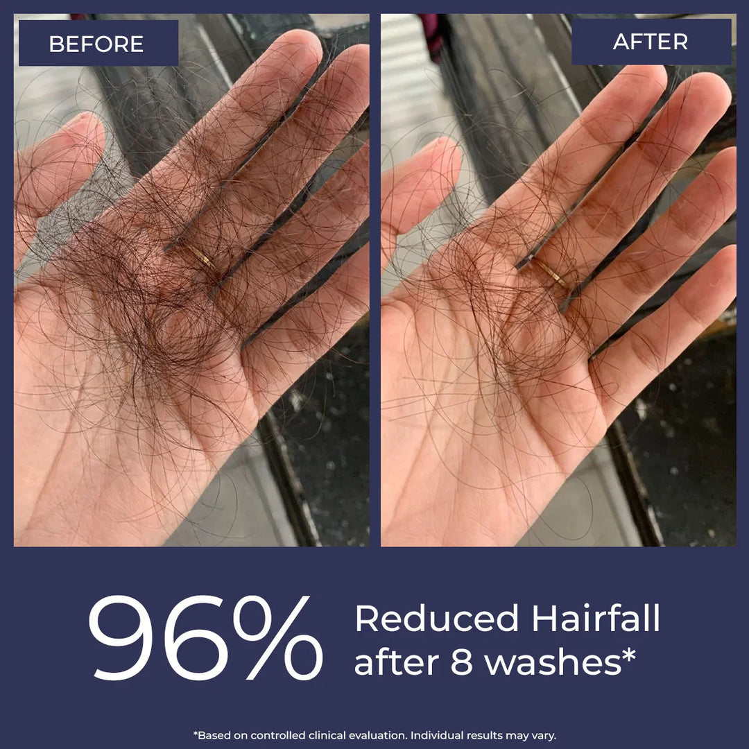 Anti-Hairfall Shampoo