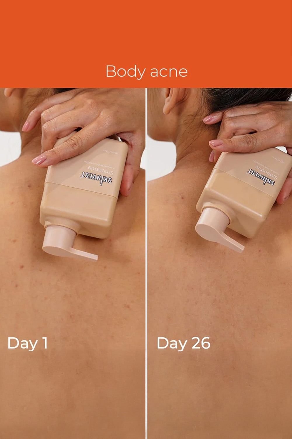 Skinvest Smoothie In-Shower Body Conditioner 150ml + Bye Bye Bumps Exfoliating Mist 50ml