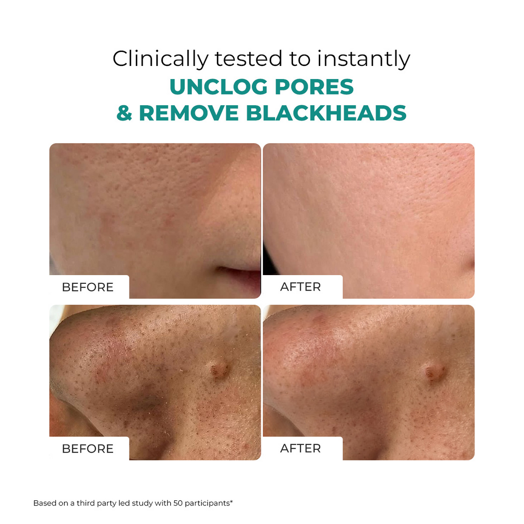 Conscious Chemist Blackhead Melting Water