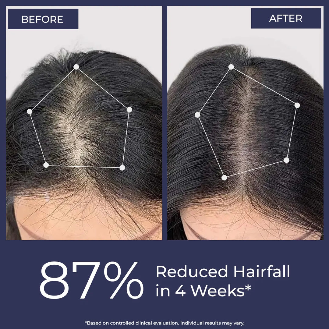 Hair Growth Serum
