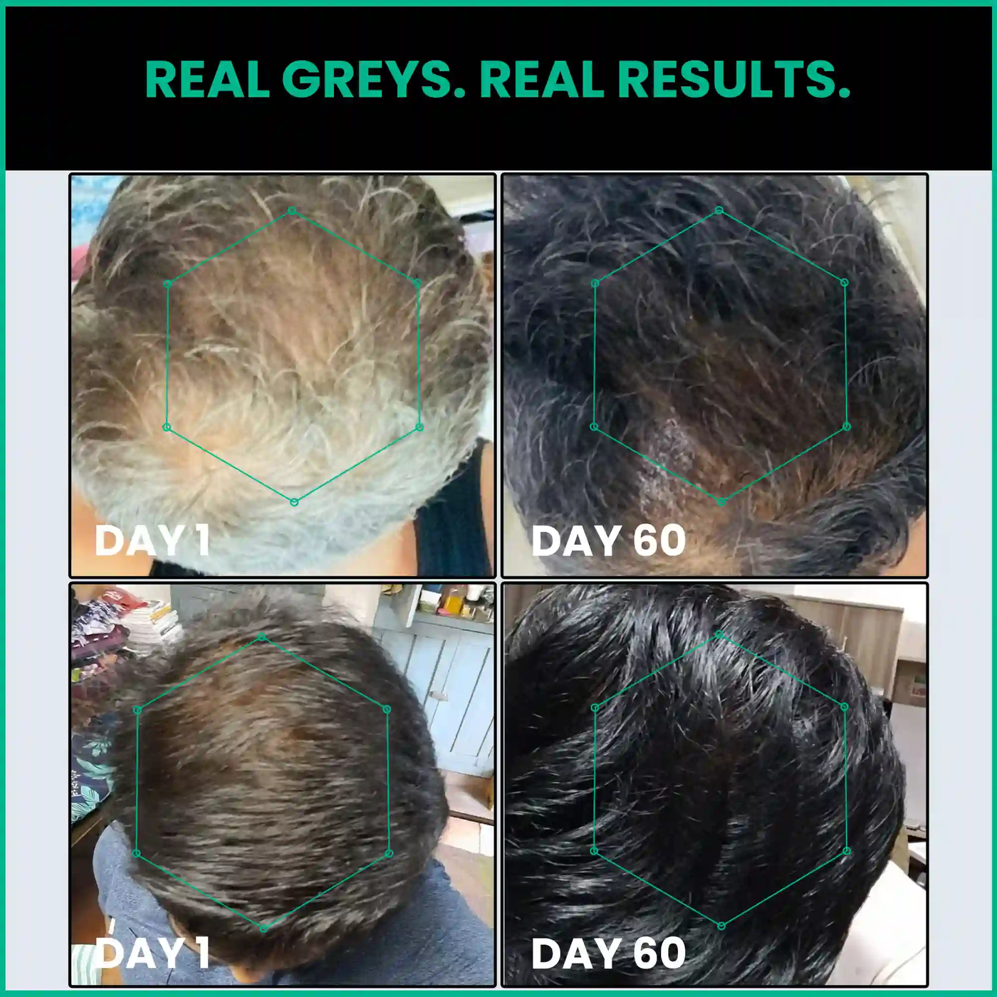 ThriveCo Hair Prime Serum With Arcolys, Biotin & Black Tea Extract, Light-Weight, Non-Sticky & Odourless Formula, Ammonia Free & Cruelty Free, 30 Ml
