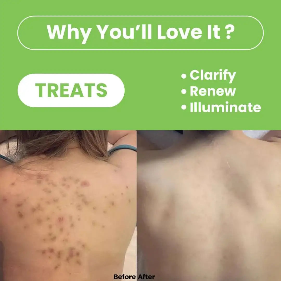 Tea Tree Combo – Clarifying & Refreshing Body Care Duo