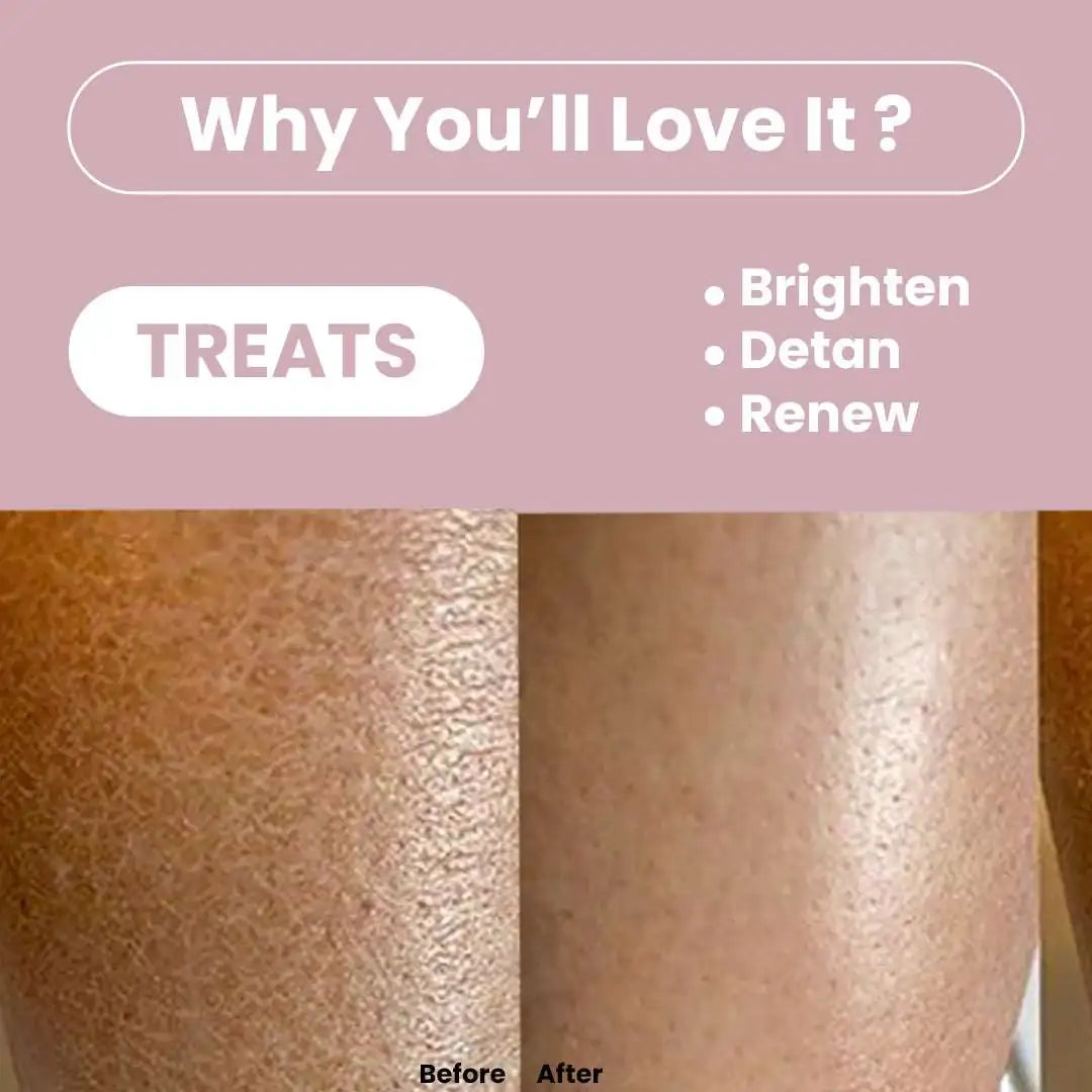 Dead Sea Mud Face & Body Scrub | Lactic Acid for Detan, Exfoliation & Skin Brightening | 200gm