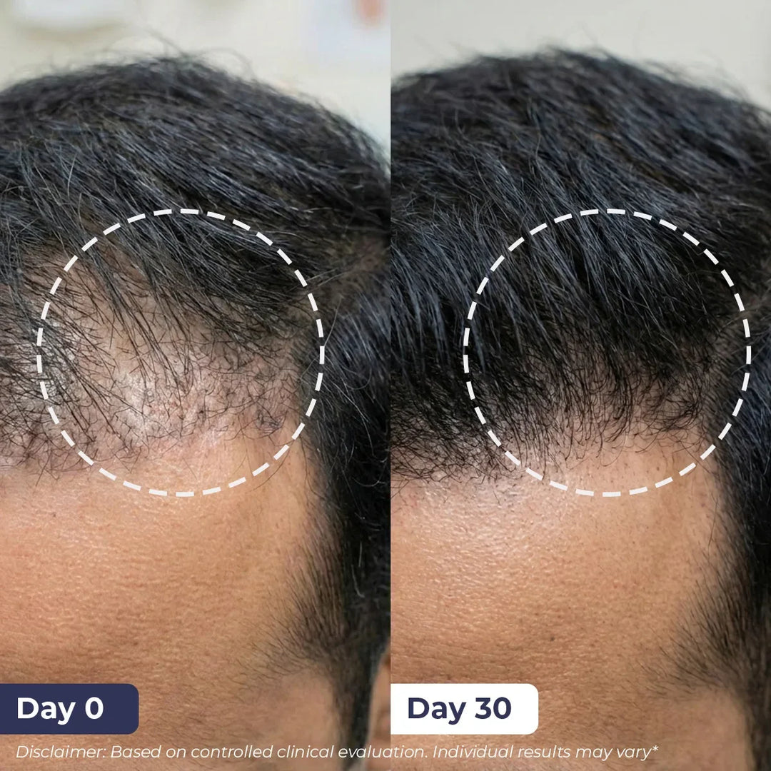 Anti-Hairfall Strength Duo | Shampoo & Conditioner | Reduces Hairfall & Frizz | Combo