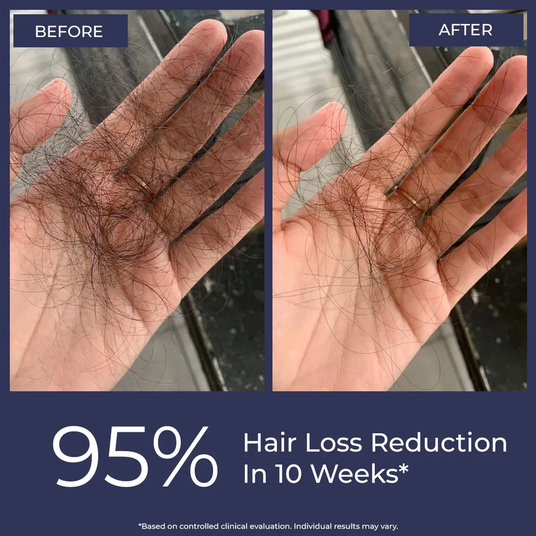 Rosemary Hair Growth Oil