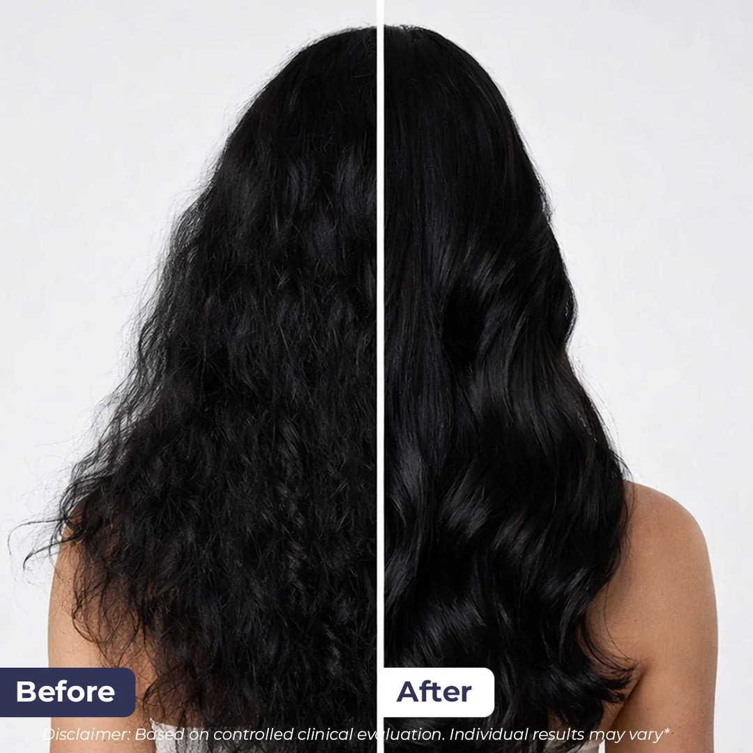 Hair Growth Duo | Shampoo & Serum | Reduces Hairfall & Supports New Hair Growth | combo
