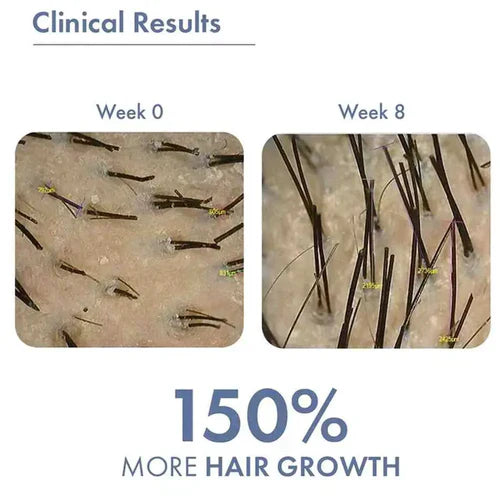 ThriveCo Hair Growth Serum 2.0, with Effective Redensyl, Anagain & Procapil