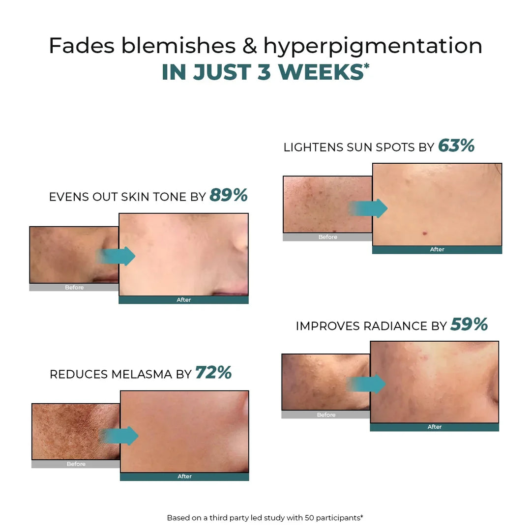 Trubiom Pigmentation & Dark Spots Treatment Serum