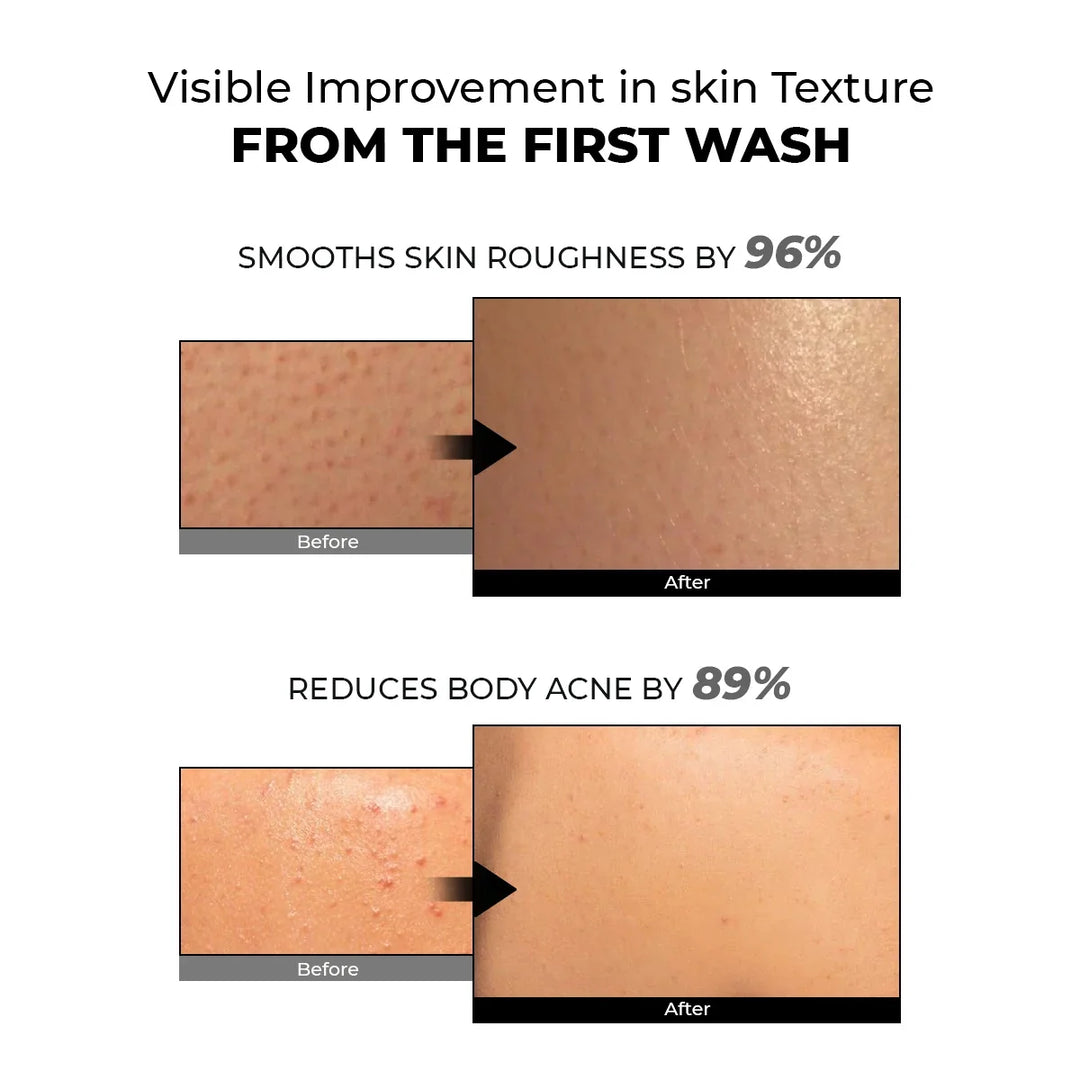Skin Reset Exfoliating Bodywash