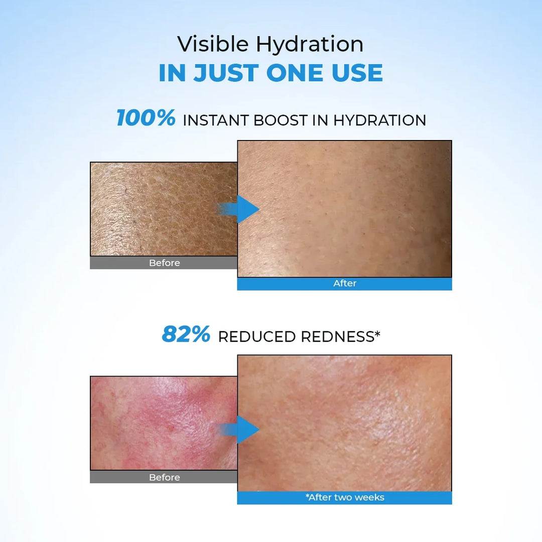 Hydro+ Multi Hyaluronic Acid Moisturiser