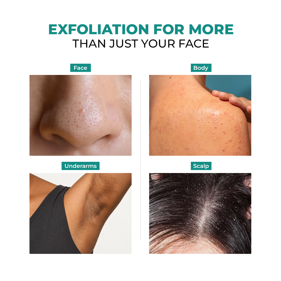 Conscious Chemist Blackhead Melting Water