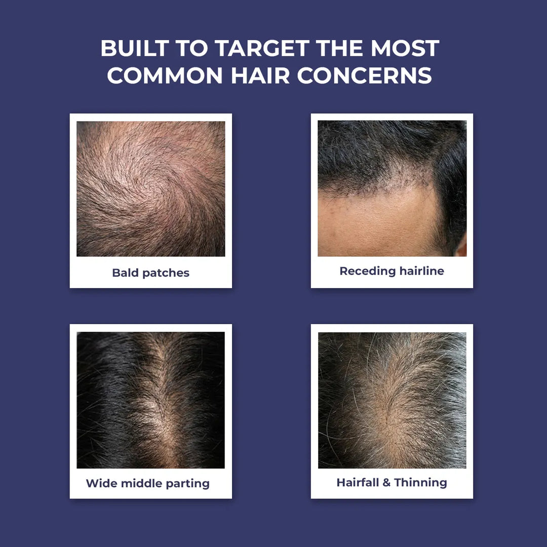 Hair Growth Serum