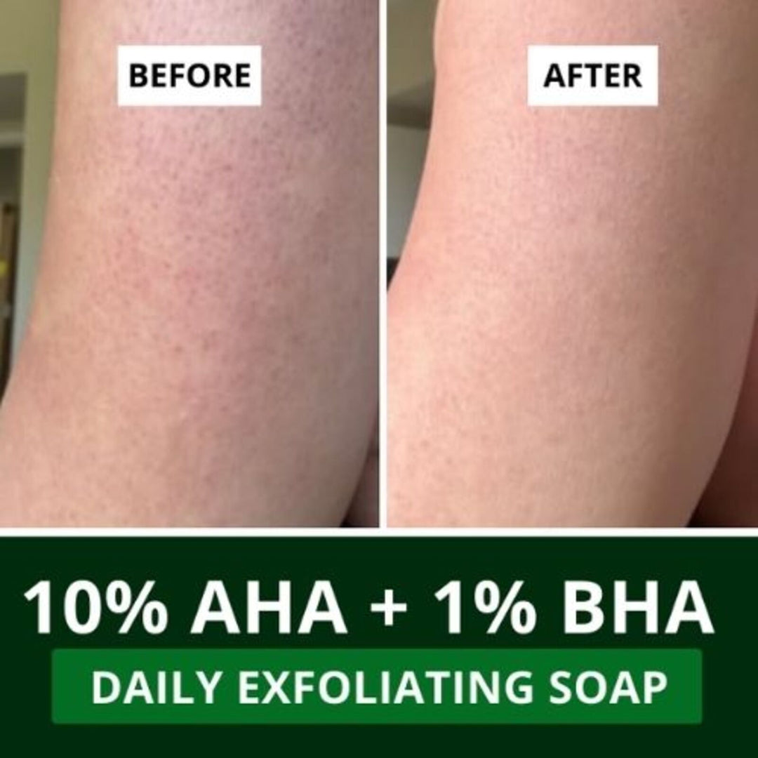 10% AHA + 1% BHA Scrub Treatment Soap (Pack of 2, 200g)
