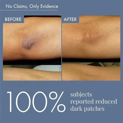 ThriveCo Dark Patches Corrector, 100ml