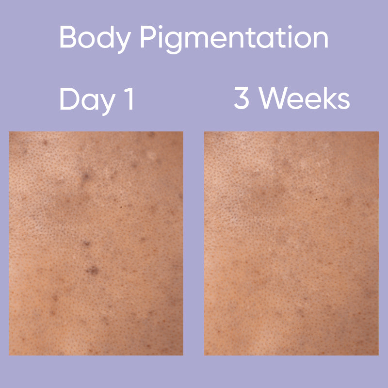 Revive my skin, body serum (200ml)