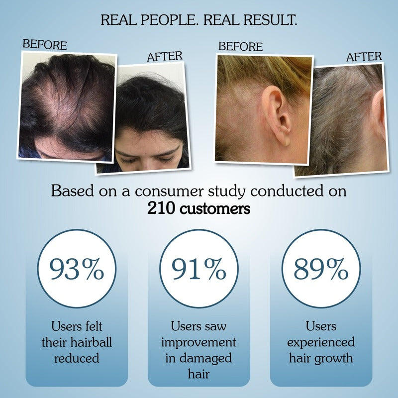 Rosemary Water Hair Growth Spray with Multi Peptides