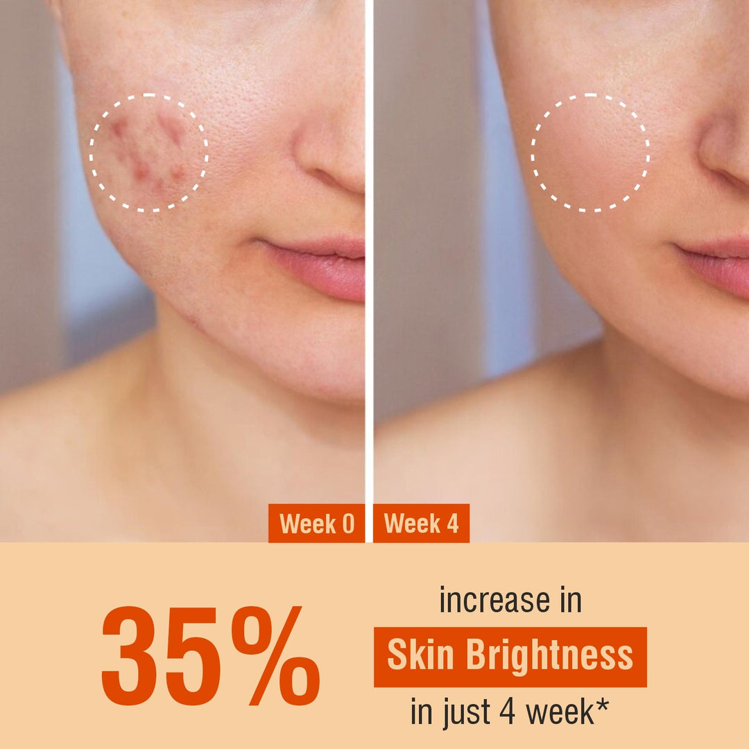 Bhoomi Herbal India VITAMIN-C + HYALURONIC ACID FACE CREAM