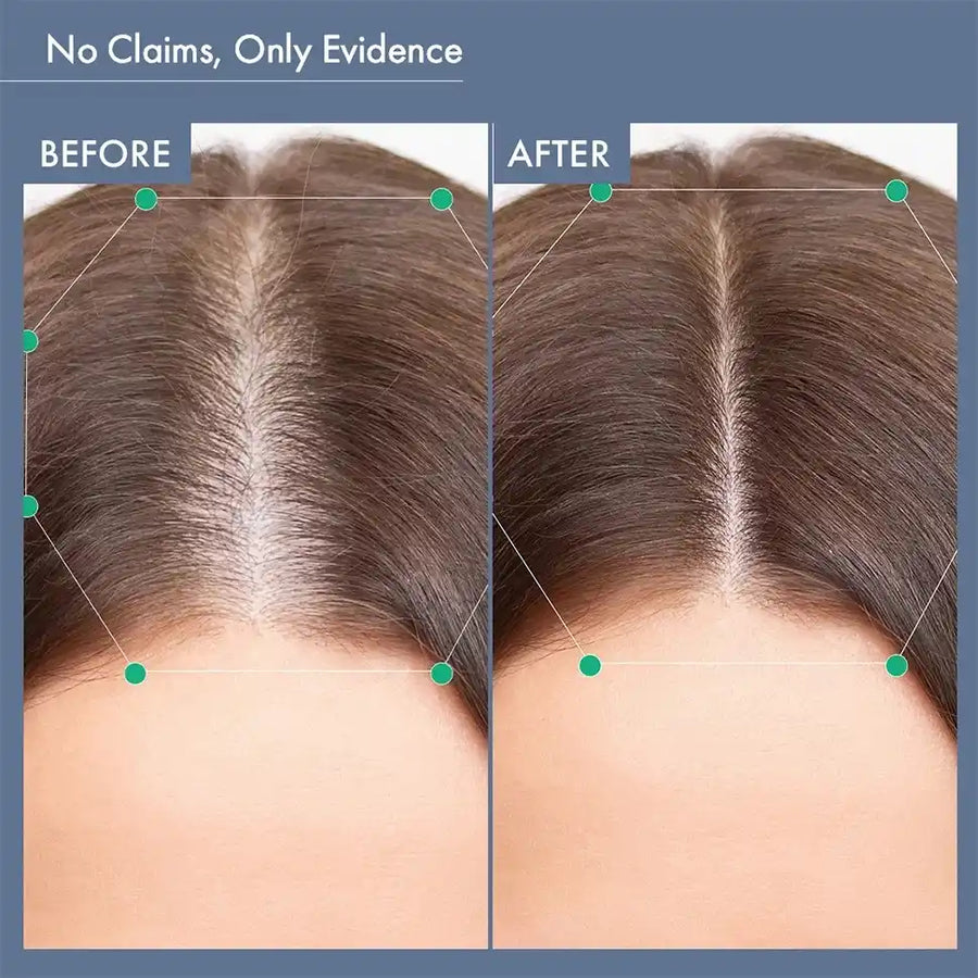 Hair Growth Serum, 50ml + Women&