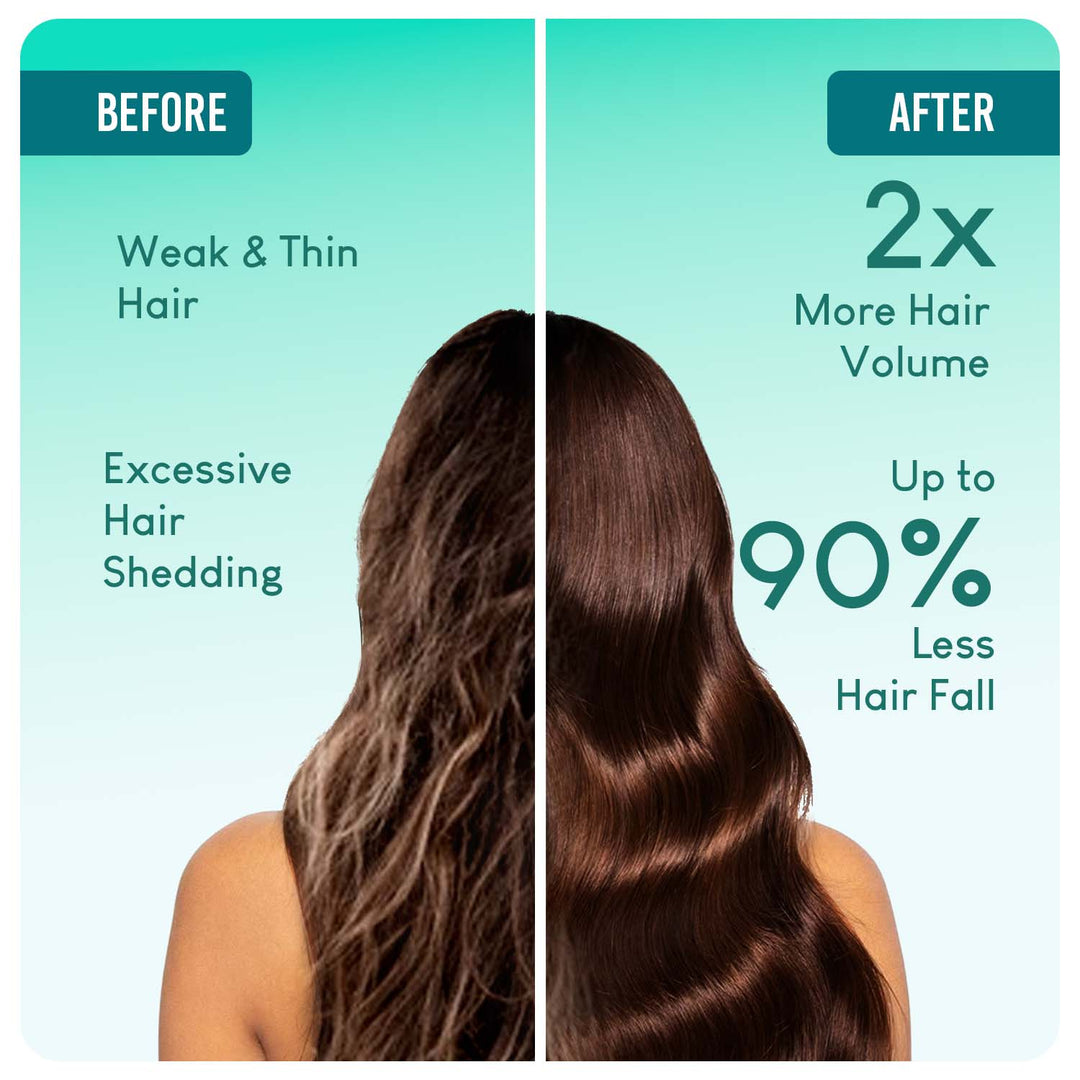 Careberry 100% Organic Rosemary & Jojoba Anti Dandruff Hair Oil, 100% Natural & Cold Pressed, Ayush Certified Ayurvedic 200ml