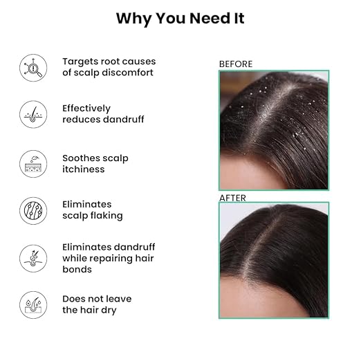 ThriveCo Scalp Clear Shampoo for Dandruff Control | For Dandruff, Flaky & Itchy Scalp | For Men & Women |  250ml