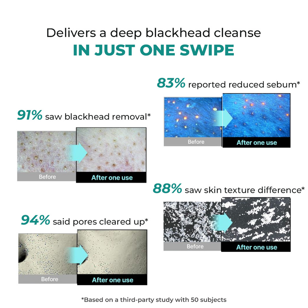 Conscious Chemist Blackhead Melting Water