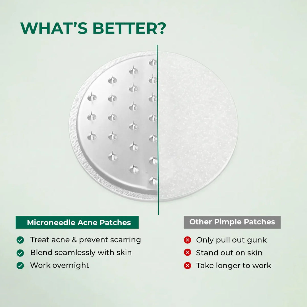 Self Dissolving Microneedle Acne Patches | 8 Patches