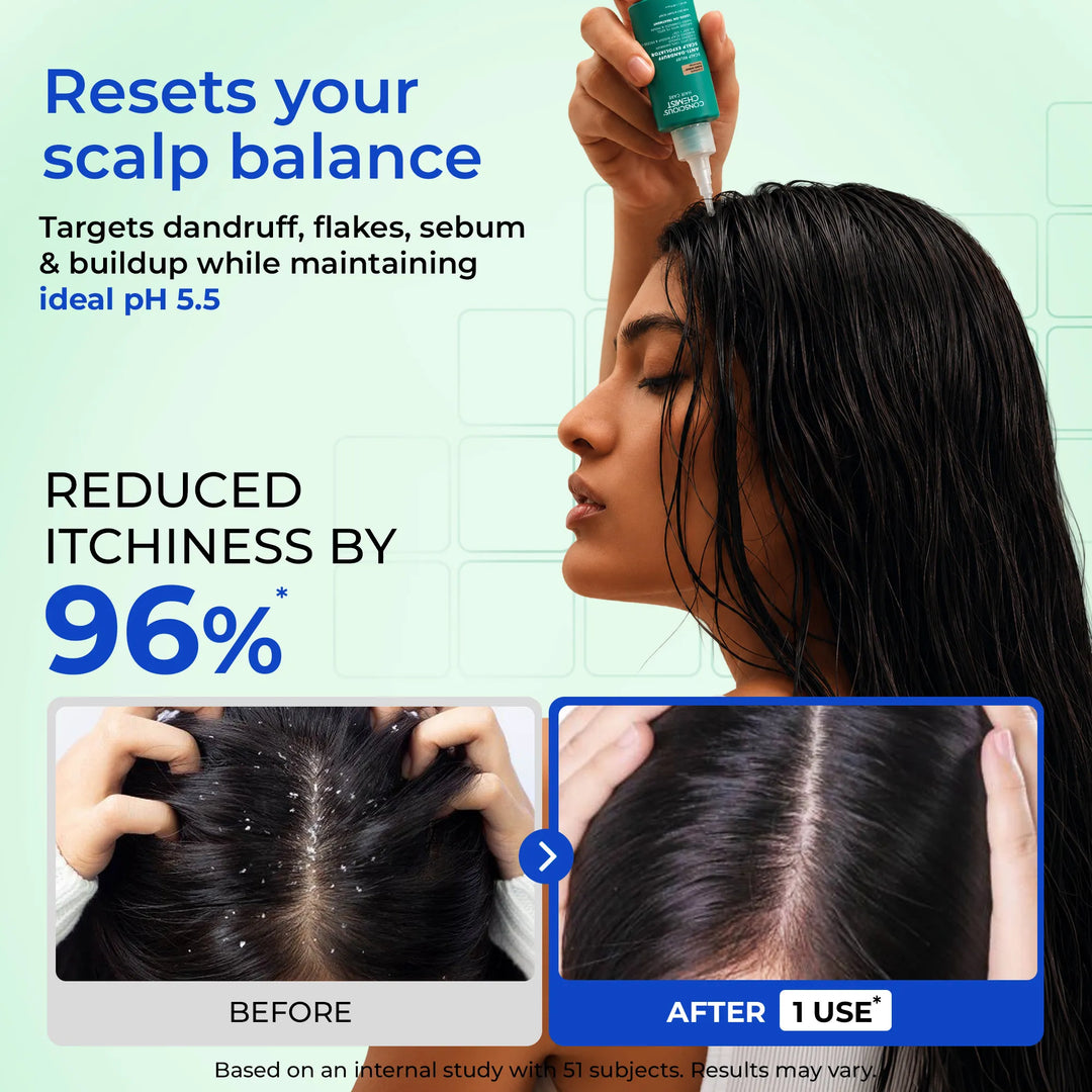 Anti-Dandruff Scalp Exfoliator