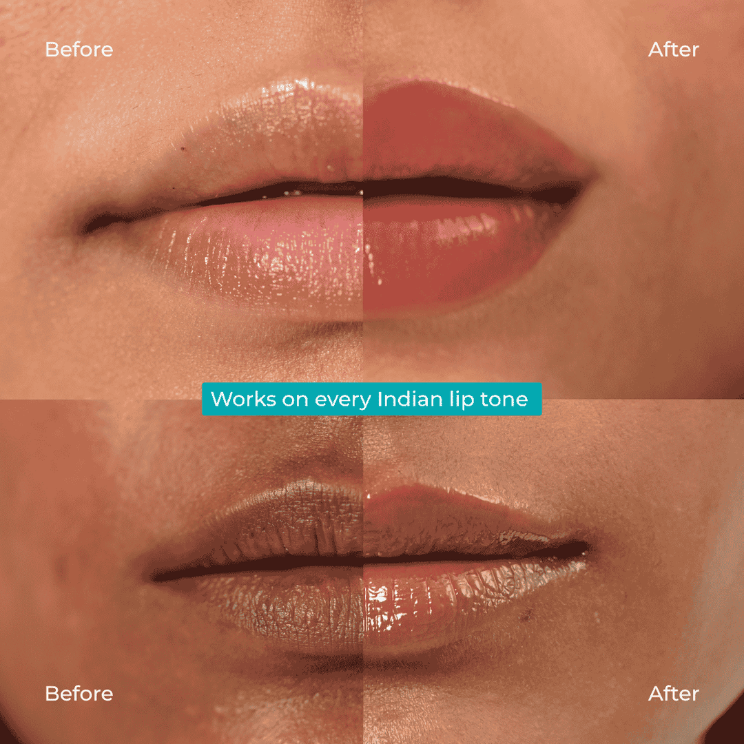 Skinvest Melts Lip Care Duo | Tinted SPF 30 Balm & Overnight Mask | 10ml + 10ml