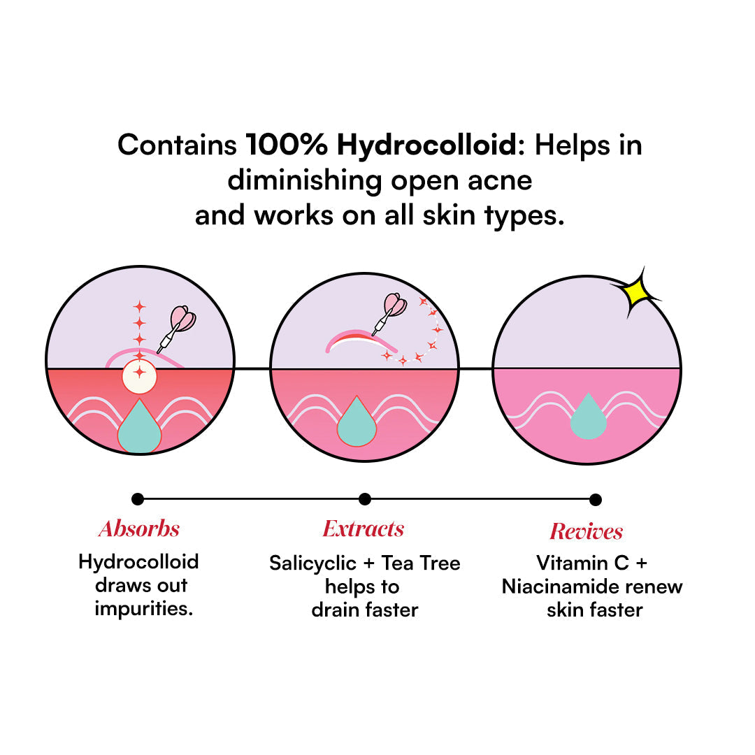 Gush Beauty Dart It Hydrocolloid Pimple Patches for Healing Acne, Zits and Blemishes - 24 patches