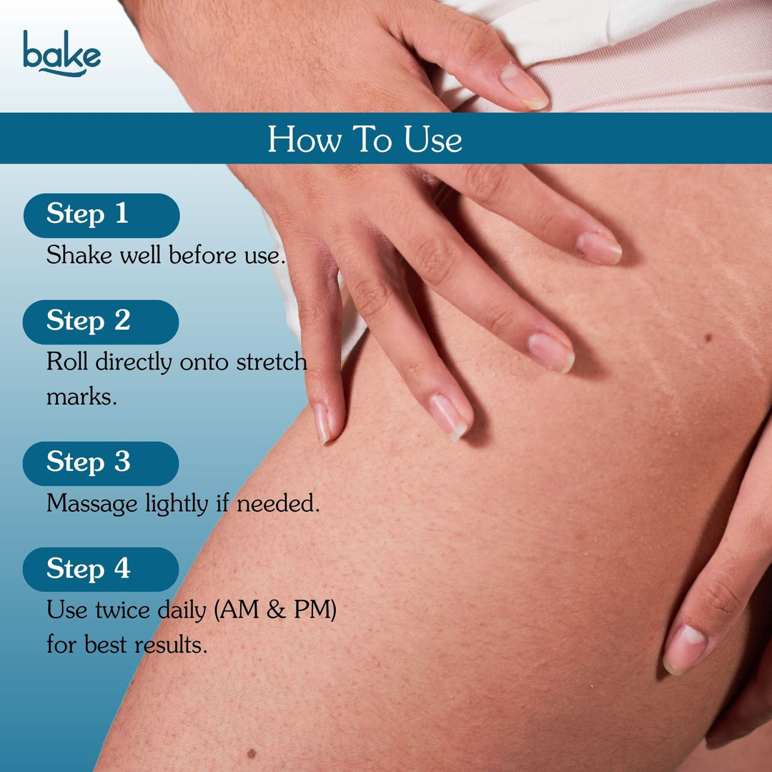 StriErase™ Stretch Marks Removal Roll On Serum