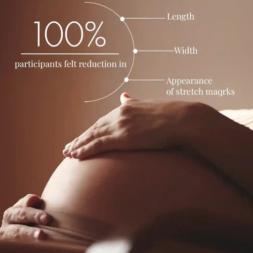 ThriveCo Stretch Mark Expert Serum Cream - 30 ml