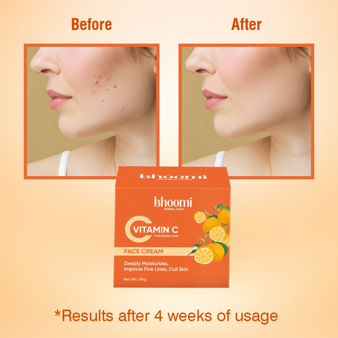 Bhoomi Herbal India VITAMIN-C + HYALURONIC ACID FACE CREAM