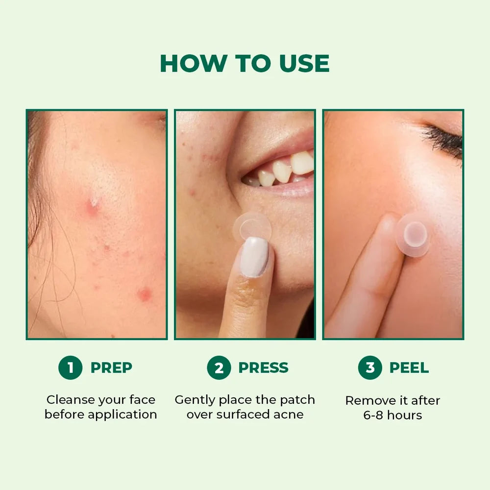 Conscious Chemist Self Dissolving Microneedle Acne Patches | 8 Patches