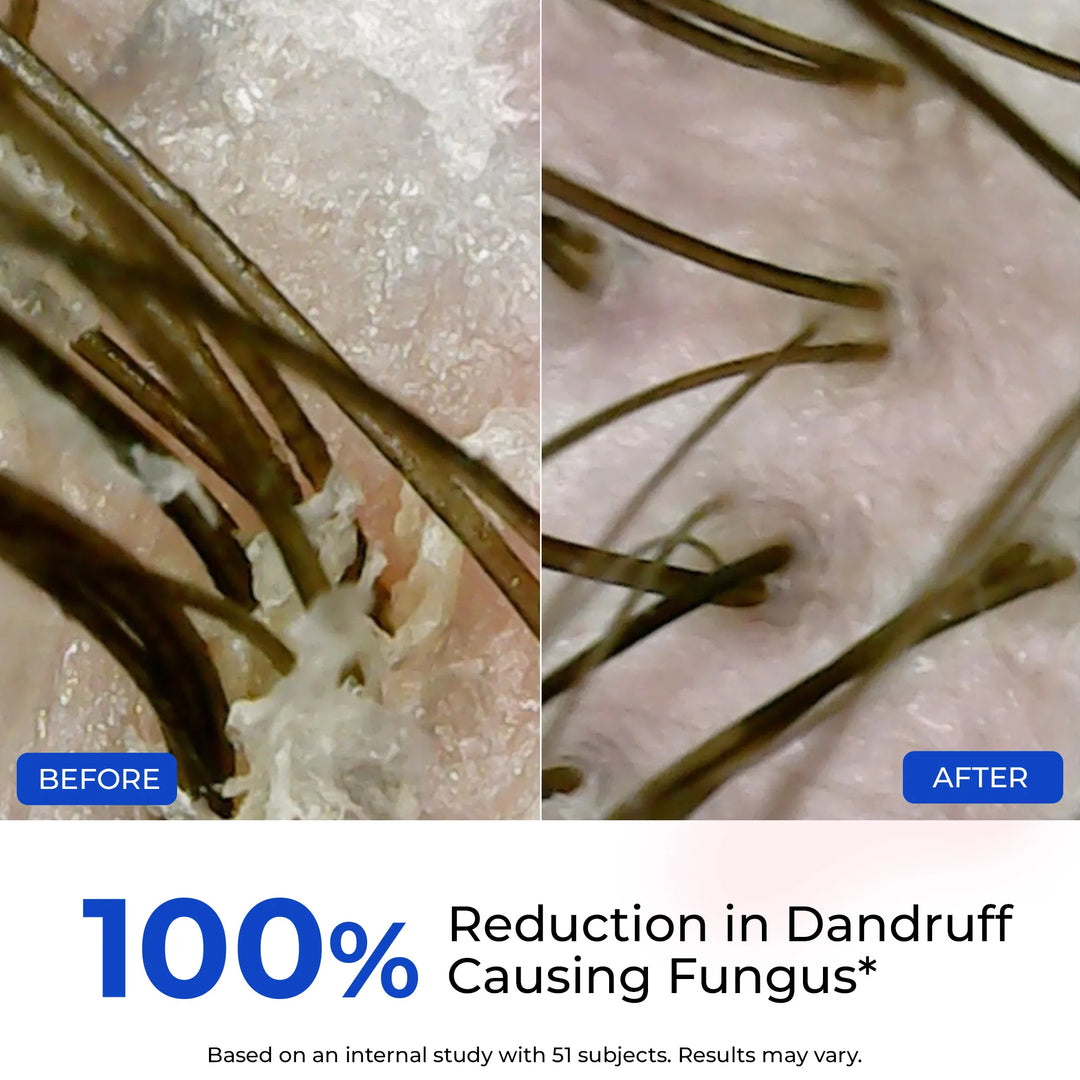 Anti-Dandruff Daily Care Duo | Shampoo & Conditioner