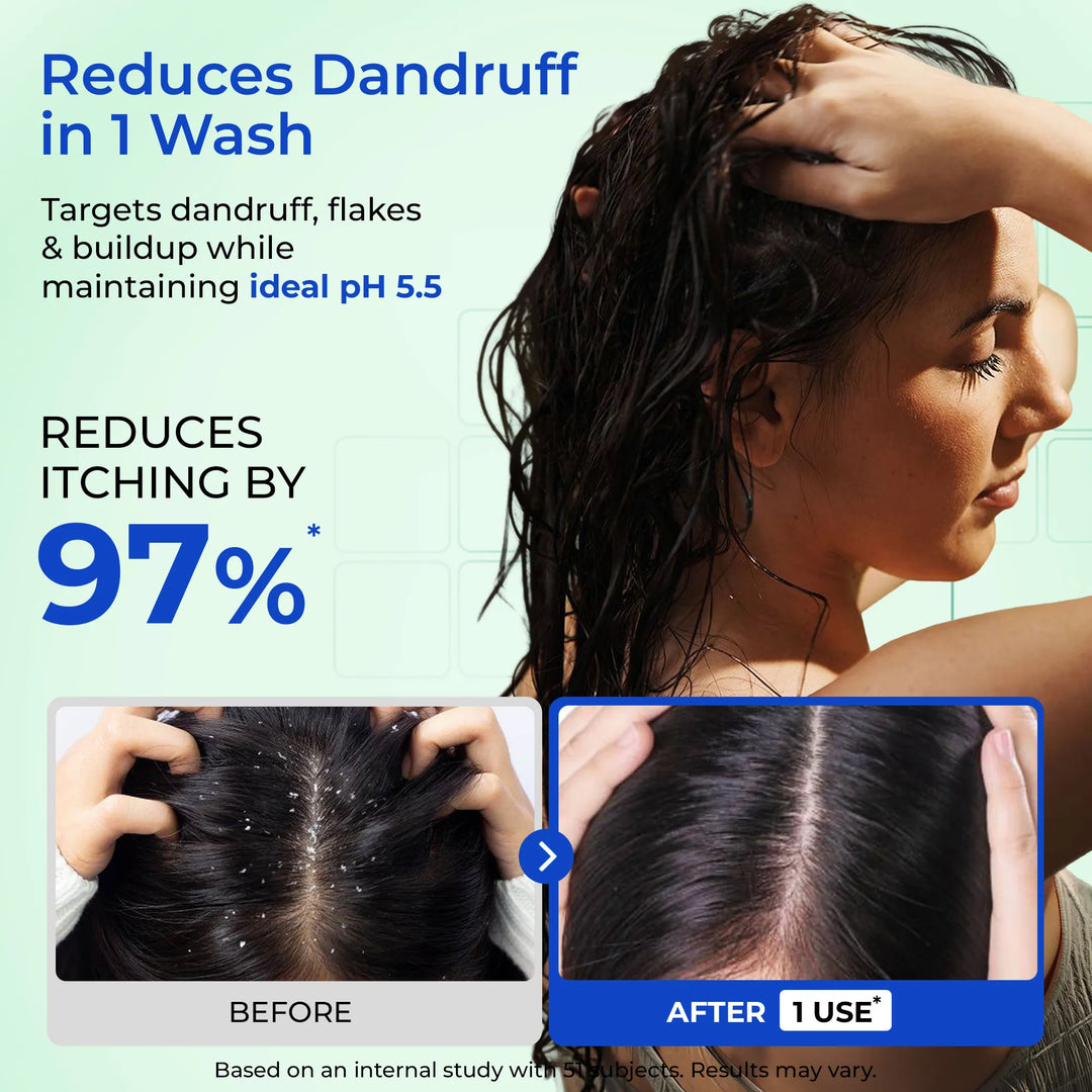 Anti-Dandruff Complete Scalp Care | Scalp Exfoliator, Shampoo & Conditioner | 3 units