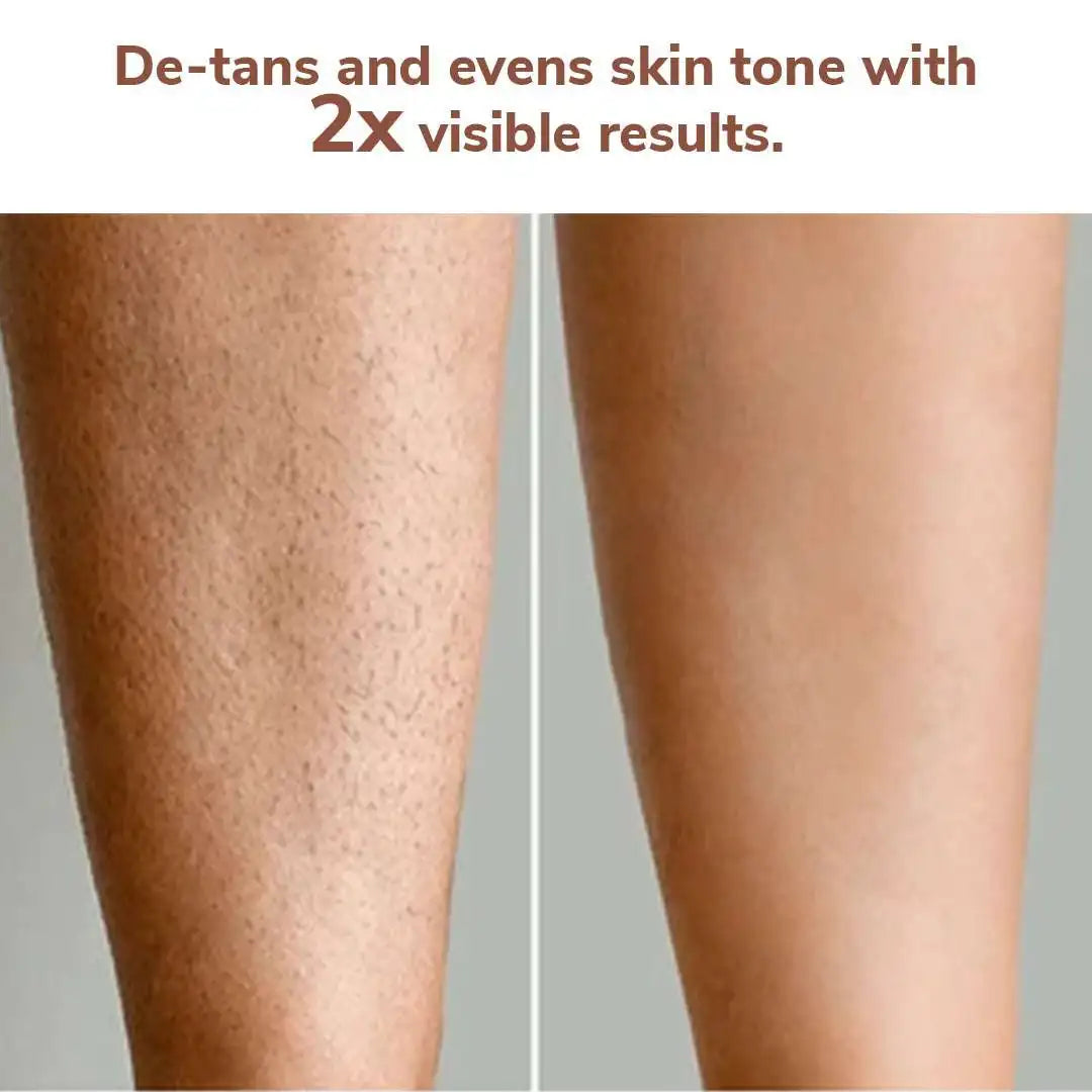 FreshLuxe Detan Combo | AYUSH-Approved | Shea Butter, Dead Sea Mud, Vitamin C & Lactic Acid | Body Lotion, Shower Gel & Scrub.