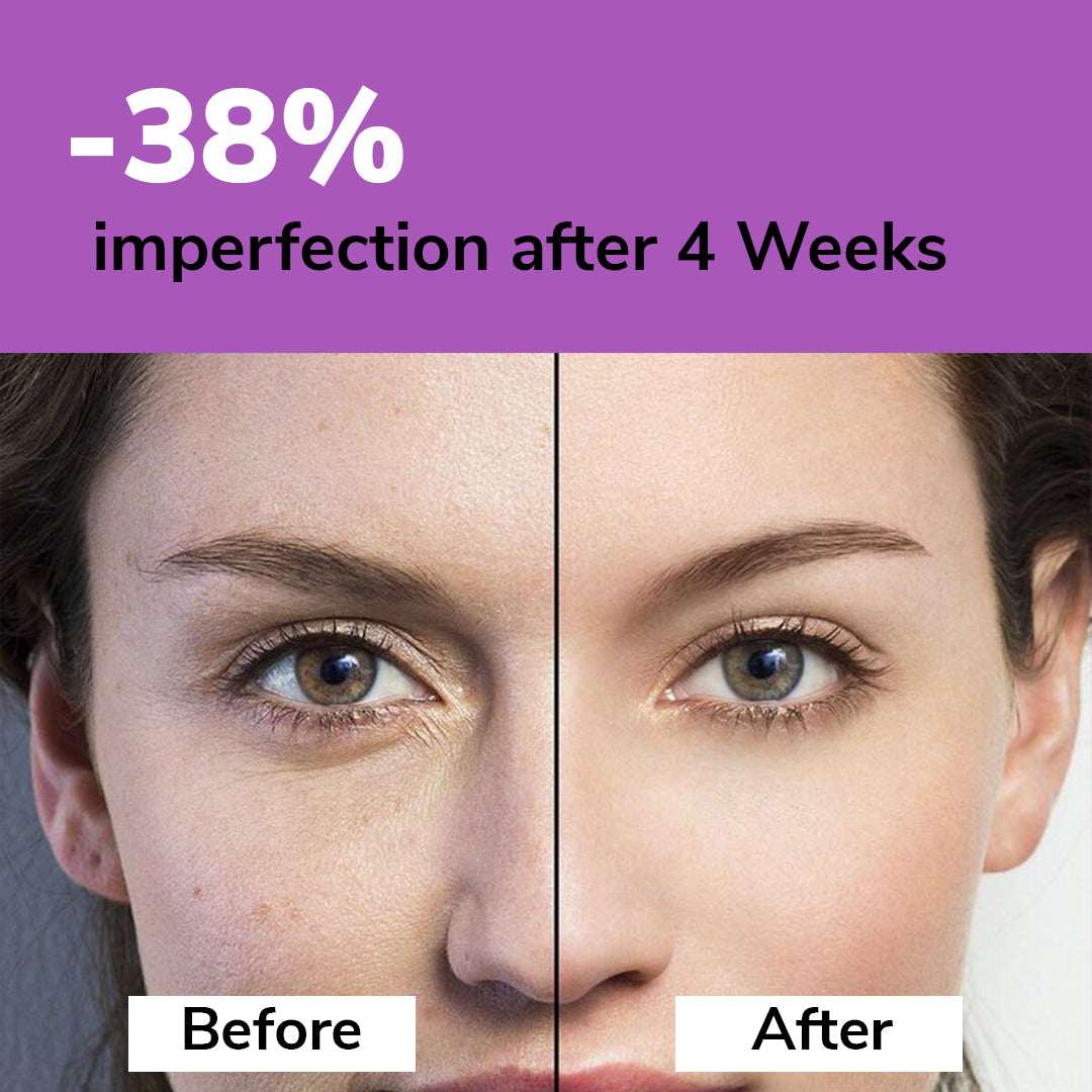 Before and after comparison of facial skin with text indicating 38% improvement after 4 weeks.