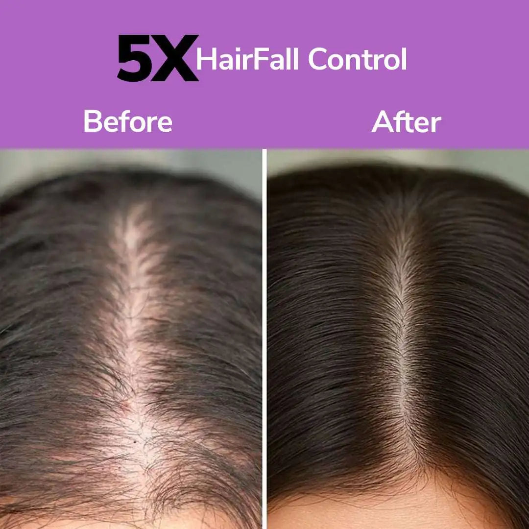 FreshLuxe Anti-Hairfall & Strengthening Combo | Rice Water & Onion Rosemary 200ml