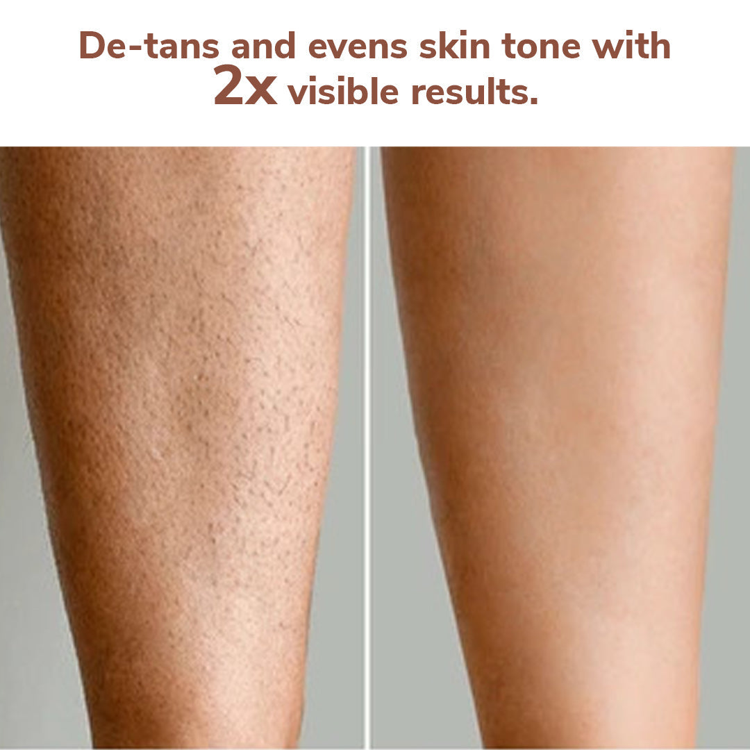 FreshLuxe Wood Myst Body Wash | Reduces Uneven Skin Tone & Dullness | Vanilla Scent