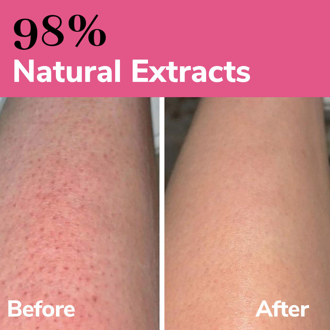 FreshLuxe Valley Whisper Body Wash | Reduces Dark Spots | Floral Scent