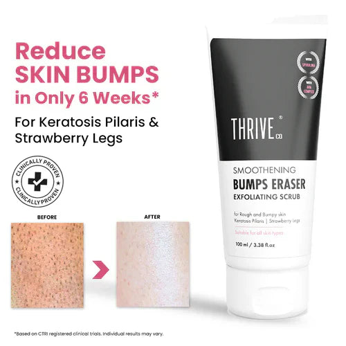 ThriveCo Bumps Eraser Exfoliating Scrub 100ml