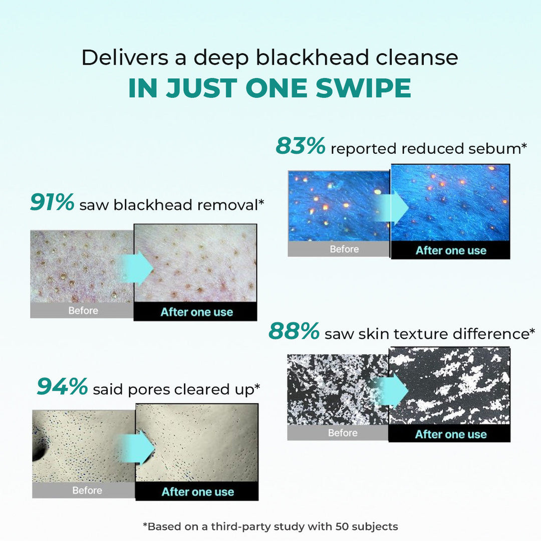 Blackhead Melting Water