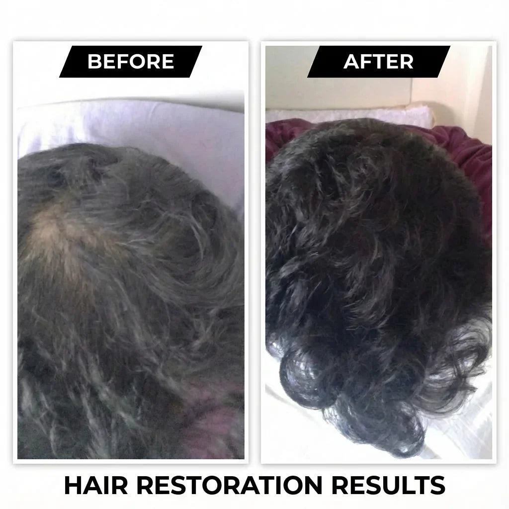 Svarasa Root Protect Natural DHT Blocker Serum